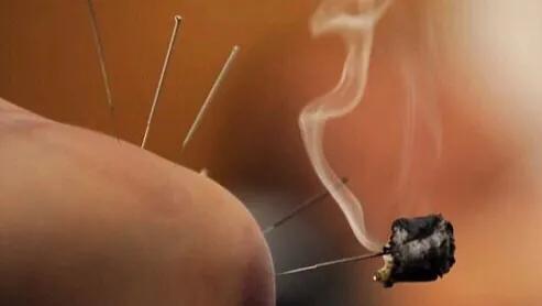 左膝关节内侧疼痛针灸治疗视频,刘红云针灸治疗膝关节内侧疼痛