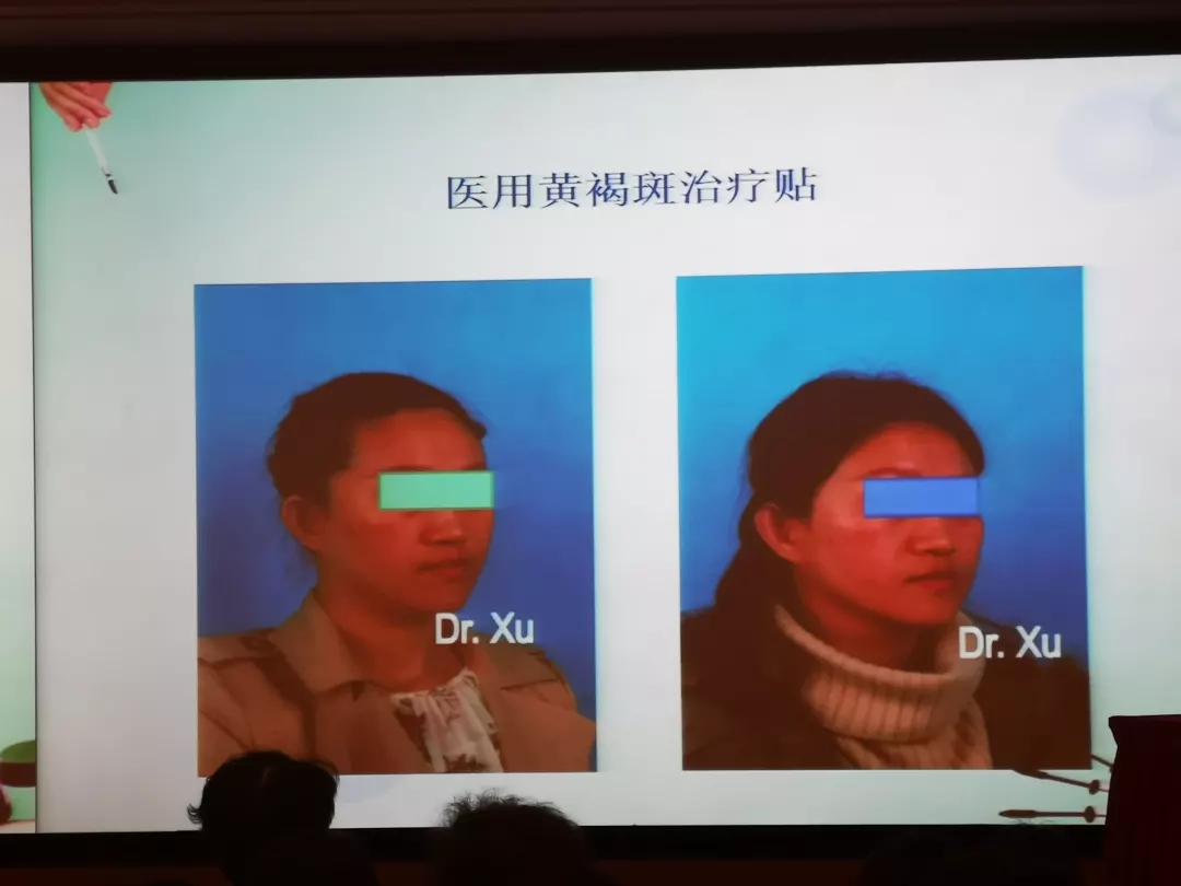 上海九院修复因子,上海九院整形科皮秒祛斑