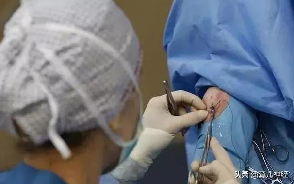 顺产撕裂与侧切有什么区别,顺产撕裂和侧切的区别是什么