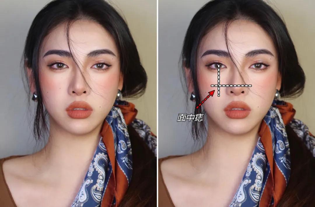 全脸点痣变美,点痣能变美吗