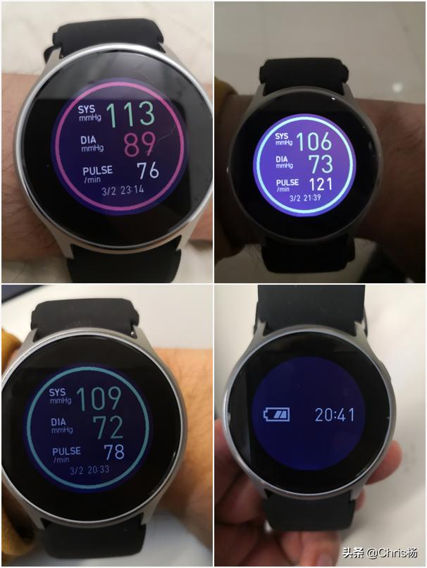 测血压血糖最准确的手表,能测血压的手表你用过吗