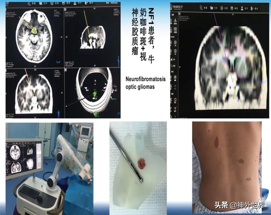 宣武医院神经外科王亚明祖籍,北京宣武医院神经科专家王亚明