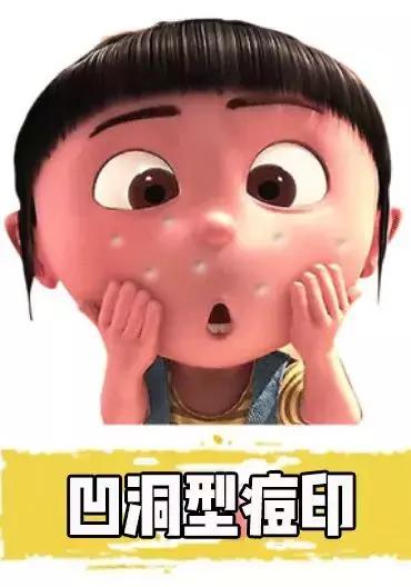 女生爆痘必买清单药膏,战痘效果最好的药