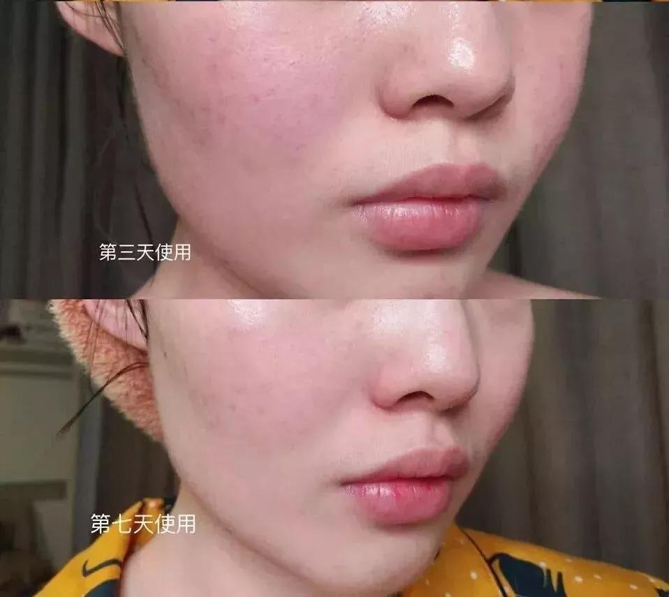 敷尔佳面膜测评红黑榜,国货面膜爆款榜敷尔佳