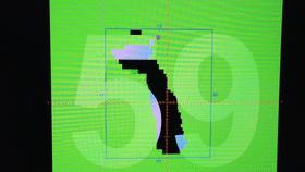 放疗新技术精准,精准杀灭癌细胞