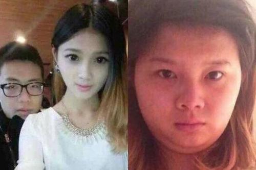 孕期长痘护肤,孕期起痘痘怎么护肤