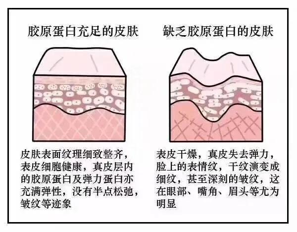 补充胶原蛋白是智商税吗,吃肉皮能补充胶原蛋白吗