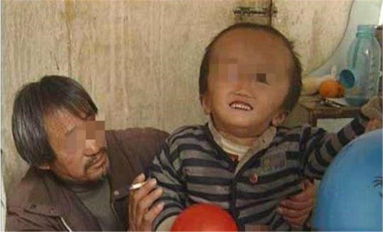 当年吃三鹿奶粉的孩子怎么样了,喝了三鹿奶粉的孩子现状照片