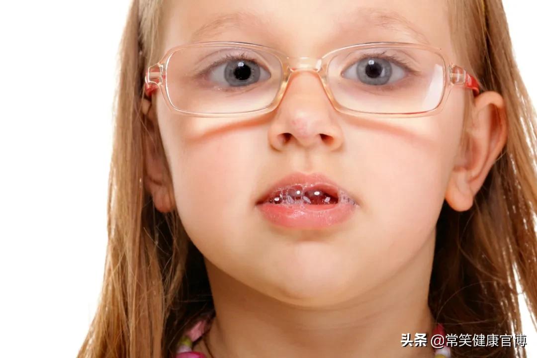 消毒水能驱走臭屁虫吗,口水可以杀菌消毒吗