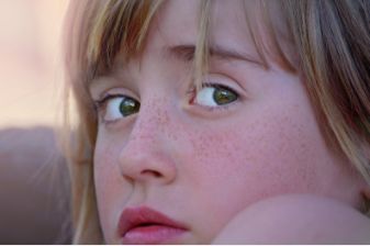 常见皮肤色斑有哪些怎么鉴别,面部色斑的鉴别诊断视频