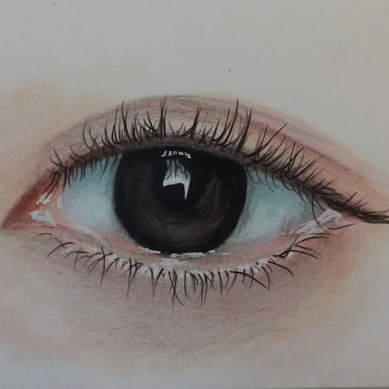 肝豆状核变性是什么遗传病,肝豆状核变性的发病几率