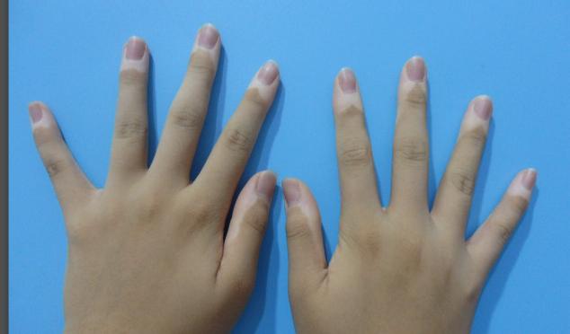 寒冷预警15度,寒冷黄色预警