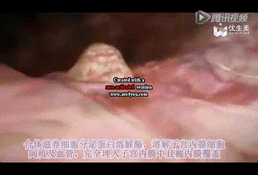 移植后神秘的14天，胚胎会发生哪些变化