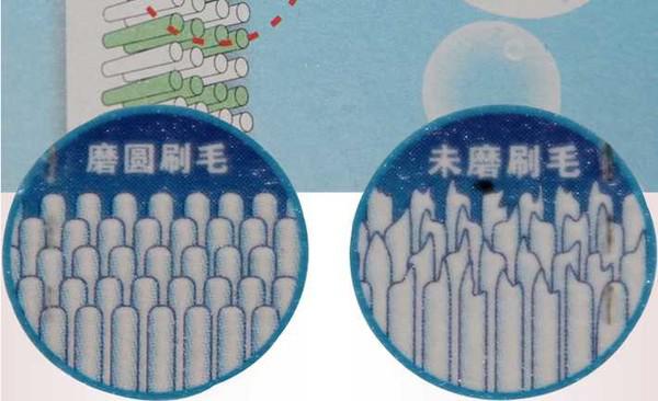 正畸的尴尬时刻，不带上它坚决不出门