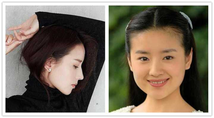 咬肌型发腮怎么改善,大脸方脸女生如何快速改变脸型