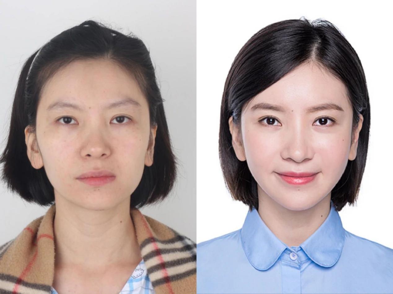 新氧公益：成就她们的变形记