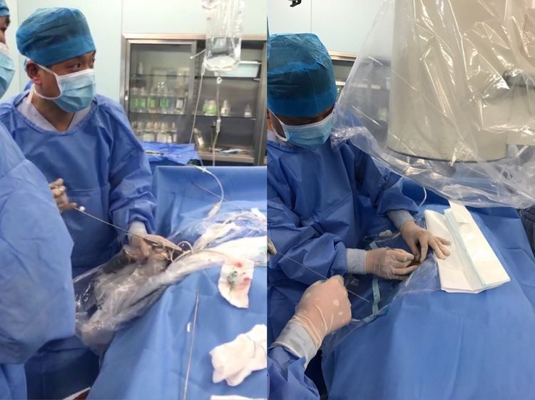 新区医院疼痛科：椎间孔镜除顽疾