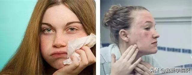 冬天脸干，连皱纹都出来了？日本女博士教你一招，抹几下白白嫩嫩