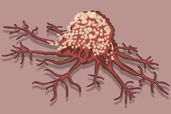 女子长期坚持喝蒲公英水，后来身体怎样？蒲公英真能杀死癌细胞？