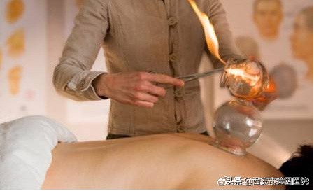 拔火罐的知识,拔火罐专业知识