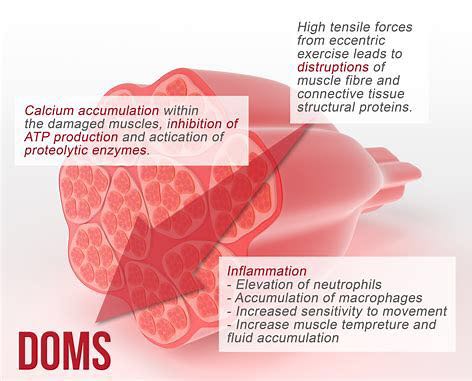 三大要点|助你摆脱“训练后的恶魔”-延迟性肌肉酸痛