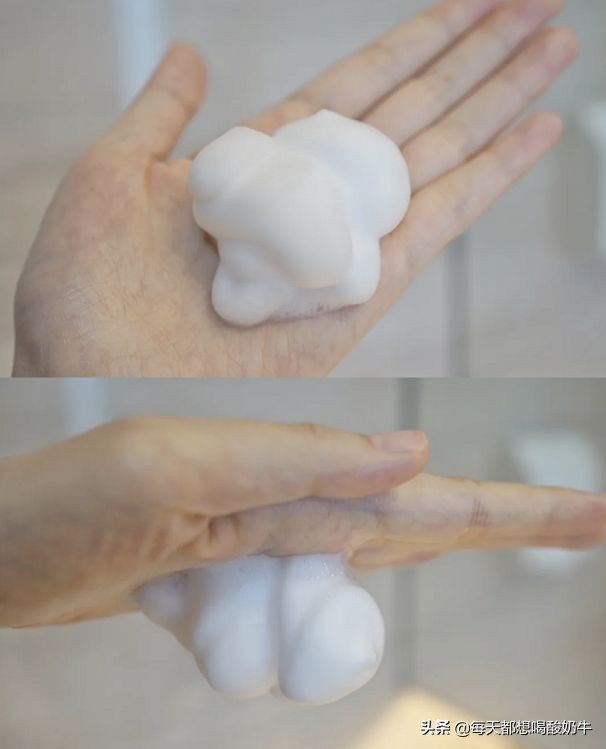 脸部毛孔大泛红有红血丝,脸部毛孔粗大有红血丝怎么改善