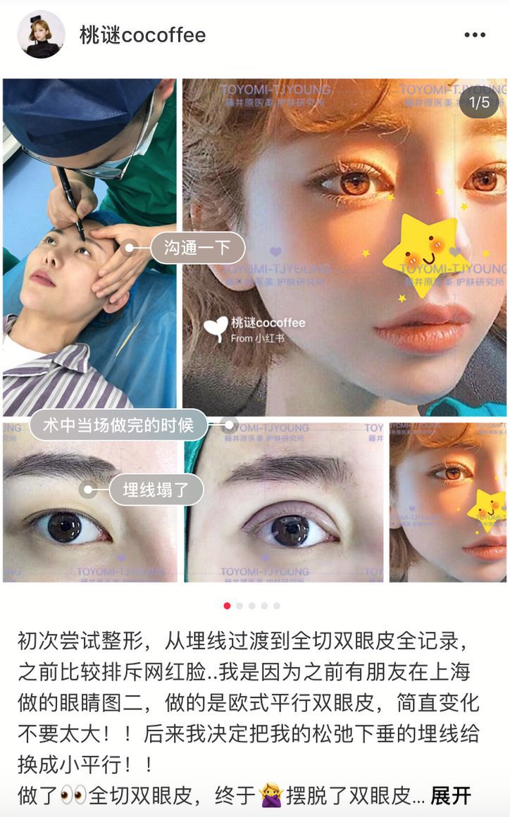 网红抽脂去世真的是意外,网红去抽脂