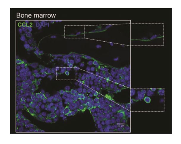 细胞饥饿疗法,细胞饥饿对细胞周期的影响
