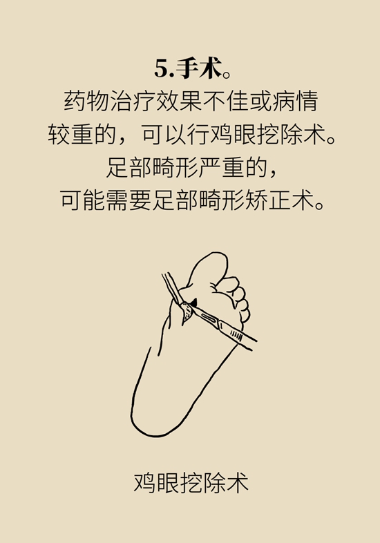 长了鸡眼该怎么办四大妙招教给你,长了鸡眼怎么治疗好得快