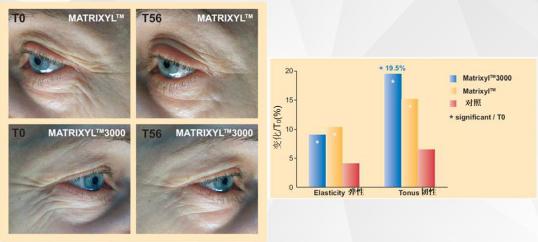 贝润原生水光日抛精华液 (贝润玻尿酸次抛精华液怎么样)