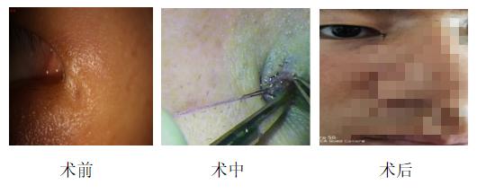 眼泪对皮肤有没有伤害,流泪对皮肤特别好