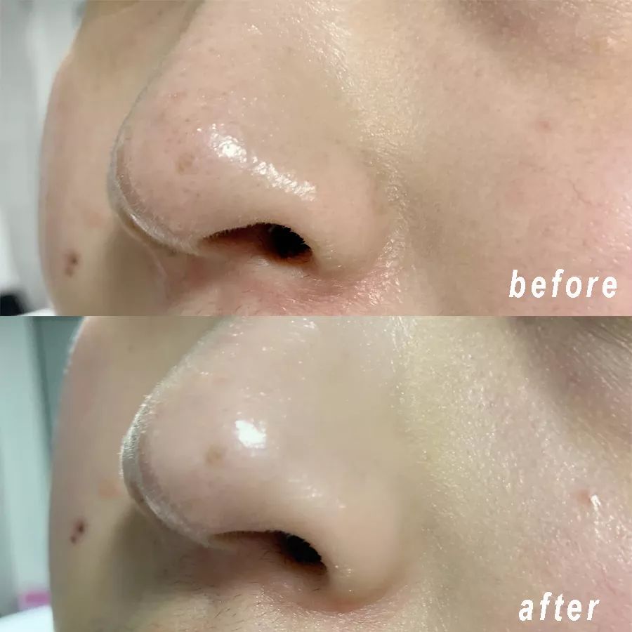 清洁面膜测评踩雷,清洁面膜测评排行榜前十位