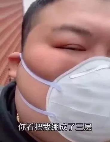 韩国瘦脸面膜真的有用吗,瘦脸面膜真的是小v脸必备