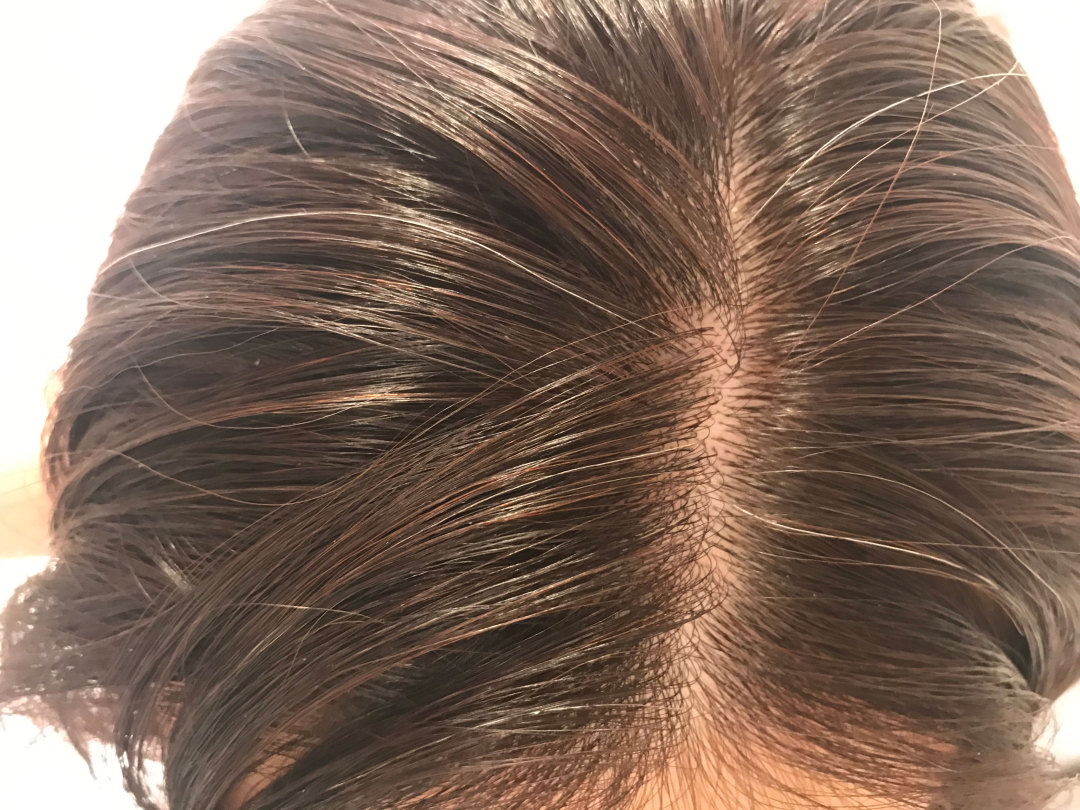 氨基酸洗发水有哪些功效养发,氨基酸养发洗发水