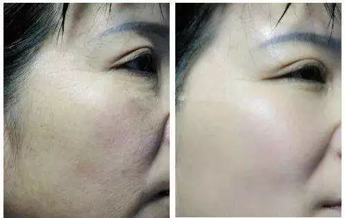 45岁金喜善素颜,金喜善冻龄秘密