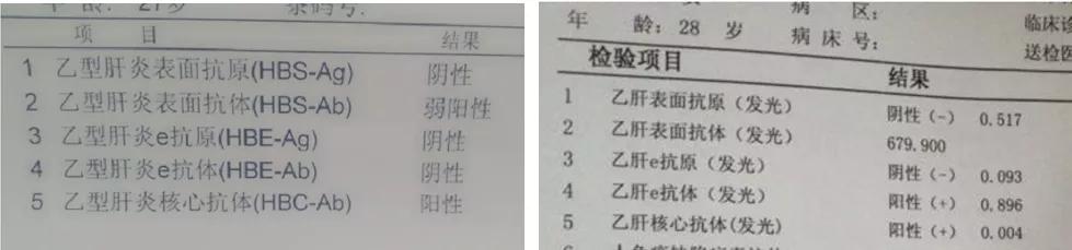 乙肝两对半15阳性,图文解读看懂乙肝两对半