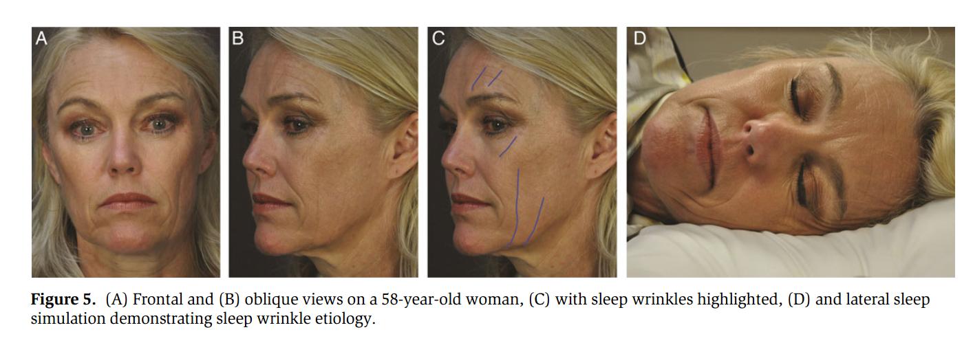 为什么我睡得比别人早却比别人困,为什么睡同样的时间我比别人困