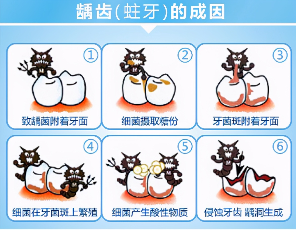 牙齿什么问题都没有,牙齿烂了一半为什么不能直接补牙