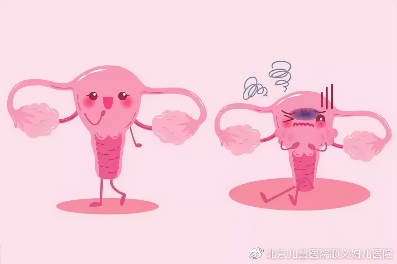 呵护女性私密健康远离难言之隐的阴道炎