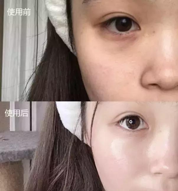 适合皮肤暗黄的护肤品李佳琦推荐,淡斑提亮肤色李佳琦推荐