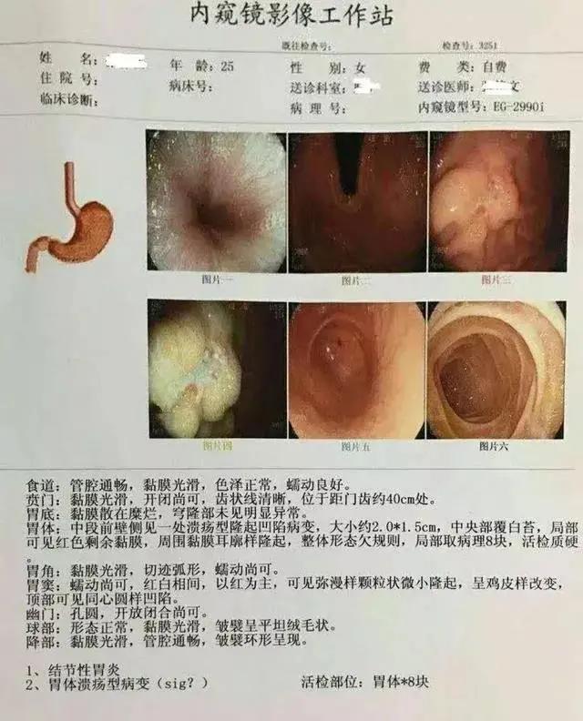 临床医生：3分钟看懂，胃镜活检病理报告！一定要收藏