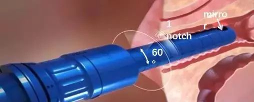 抗衰才是护肤最重要,想抗衰做哪个项目比较划算