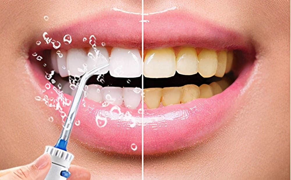 春季唇妆,唇妆不好看