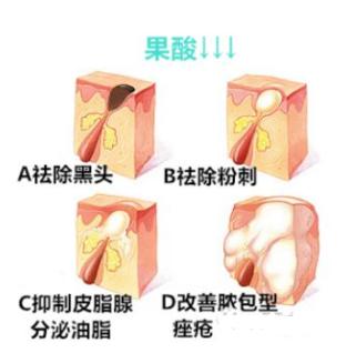 女子护肤品过敏,女孩网购护肤品