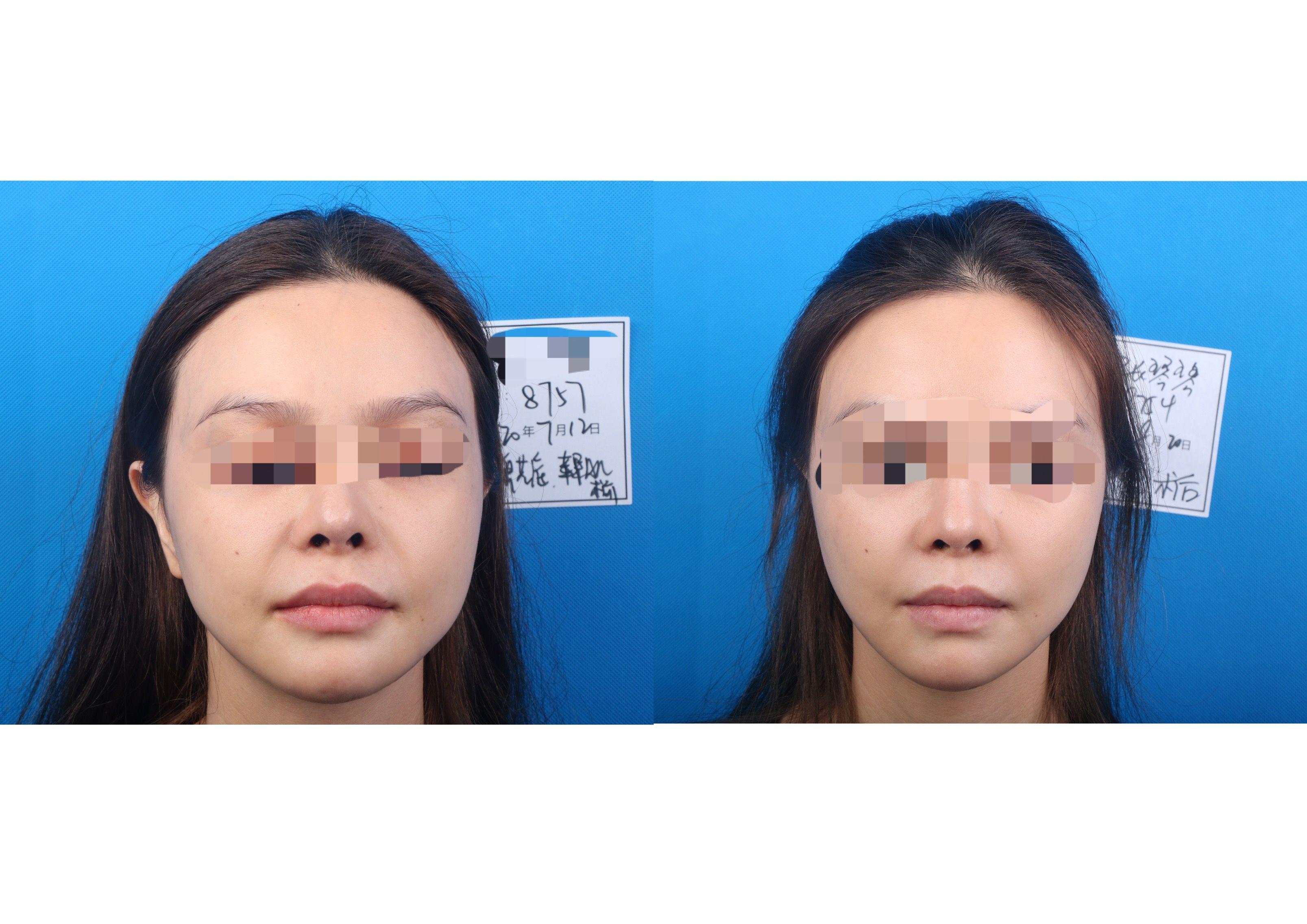 福华医疗美容医院正规吗,福华医疗美容医院怎样