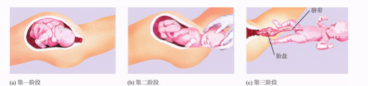 婴儿早期的条件反射,20个常见婴儿反射