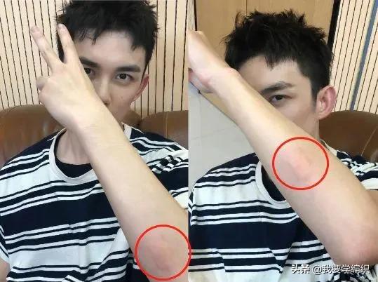 你知道蚊子为什么被扇吗,蚊子除了怕蚊香害怕什么