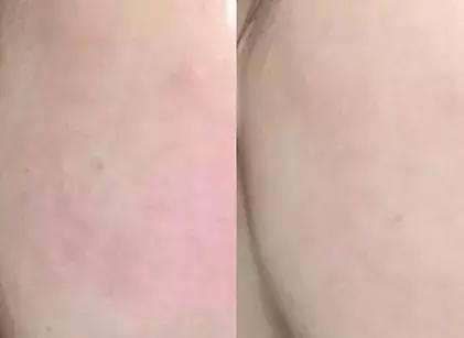 十大公认最差水乳,十套水乳