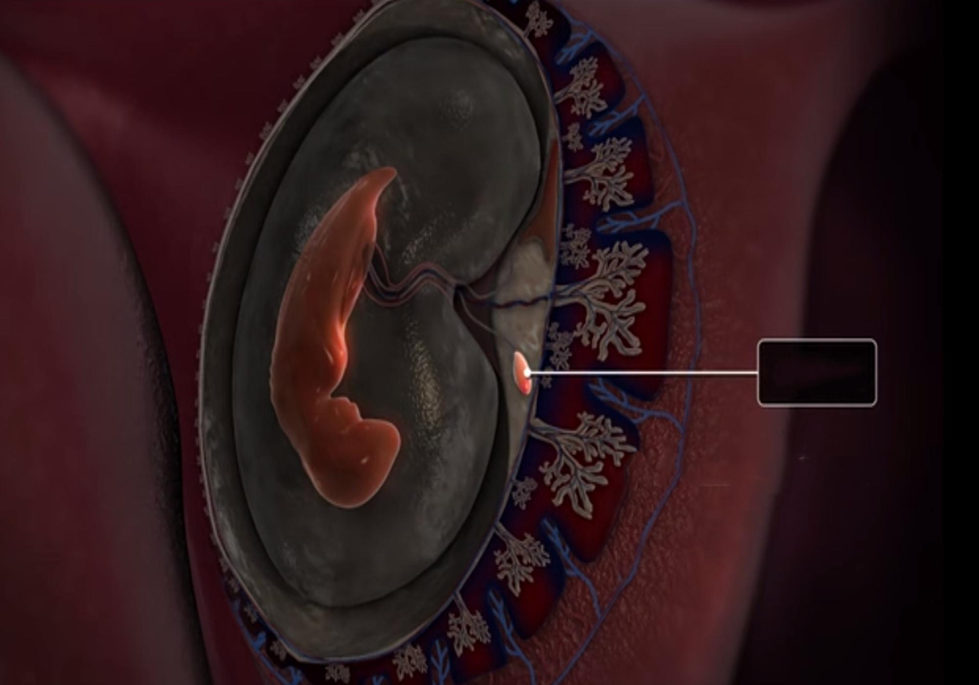 胎心发育全过程高清图,3胞胎孕囊胚胎的发育全过程视频