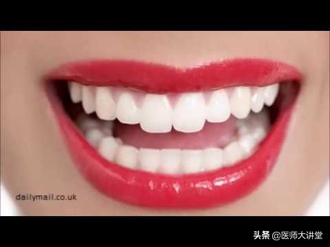 牙齿种植和口腔修复,口腔咨询牙齿矫正提问技巧